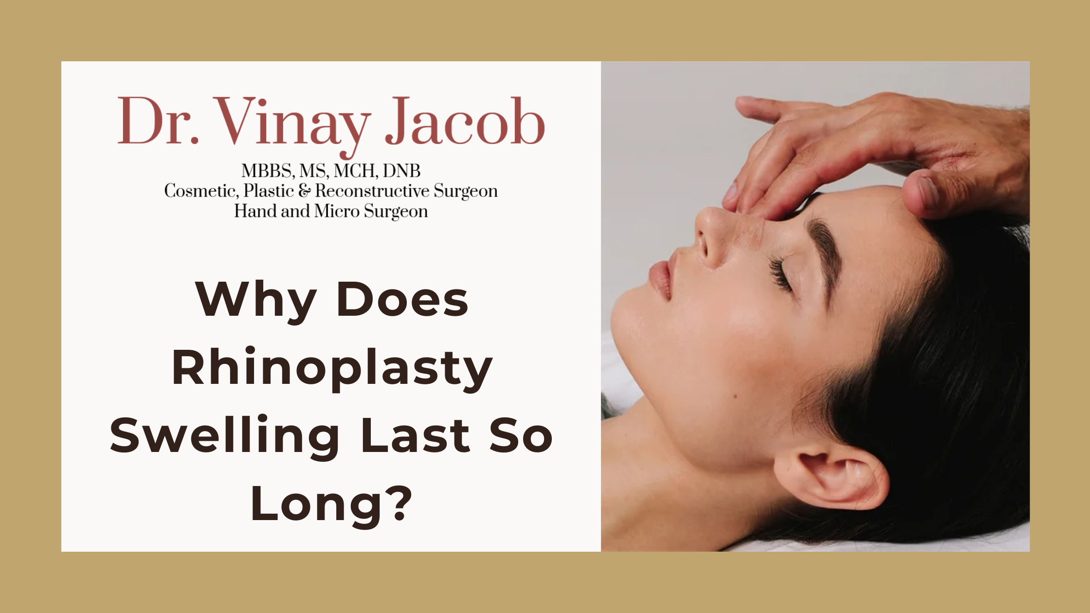 Why Does Rhinoplasty Swelling Last So Long?